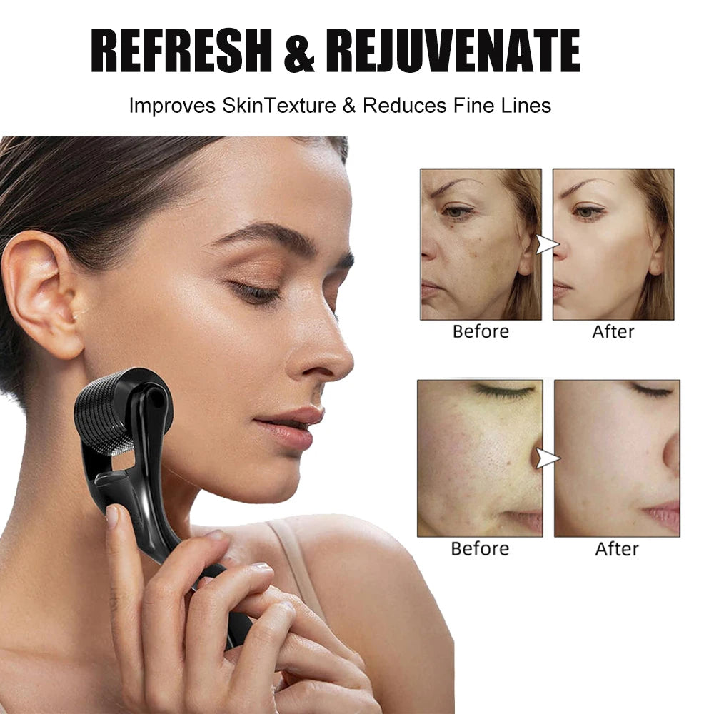 Derma Roller 540 for Face, Beard & Skin Care