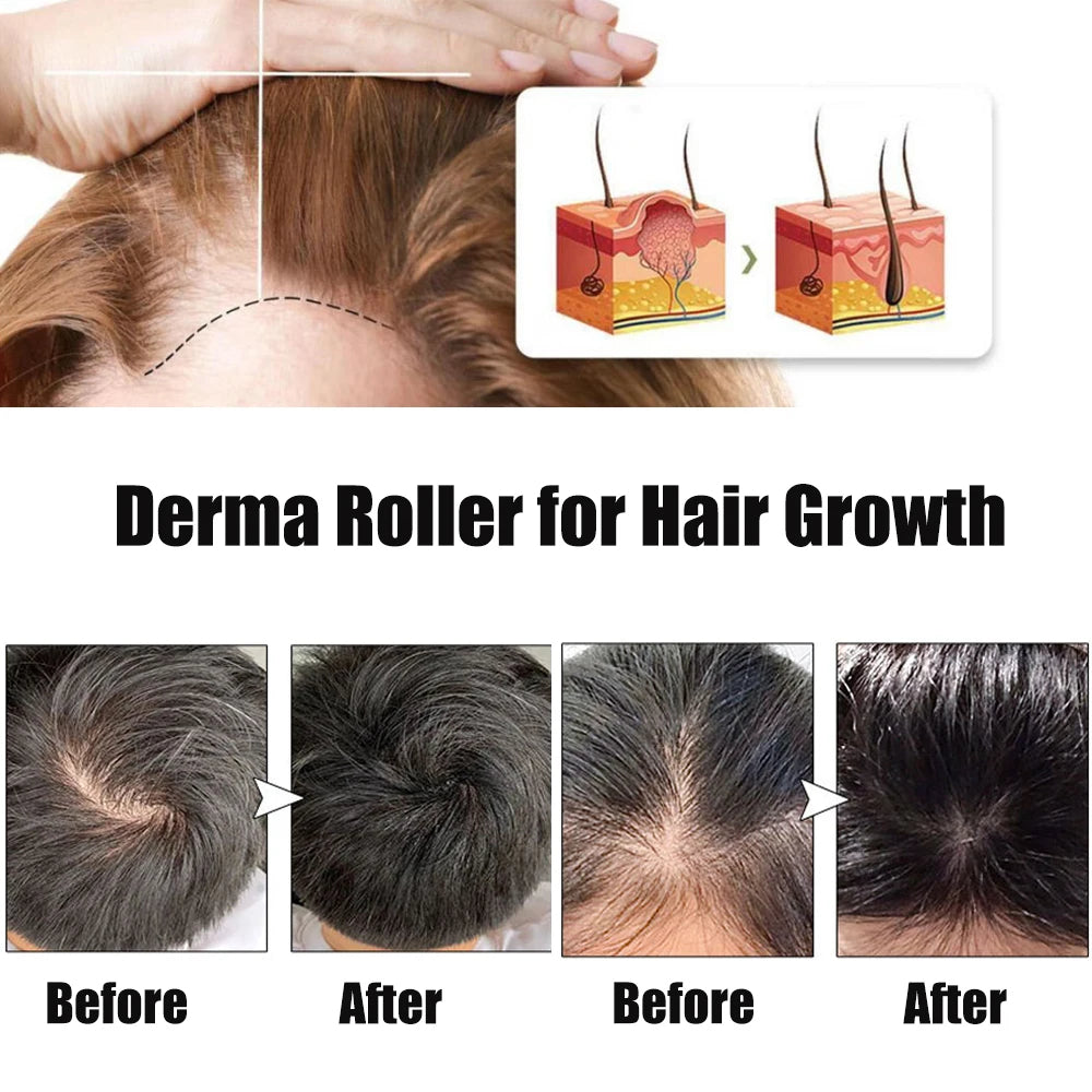 Derma Roller 540 for Face, Beard & Skin Care
